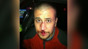 Must have been some badass Skittles